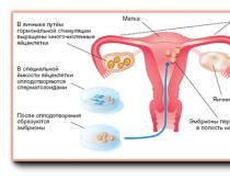 गर्भाशय की प्रक्रियाओं की सहनशीलता और रुकावट का क्या अर्थ है?